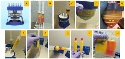 A Feasibility Study on 3D Bioprinting of Microfat Constructs Towards Wound Healing Applications